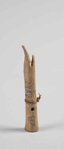 Tibia